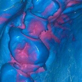 Dental Impression distortions