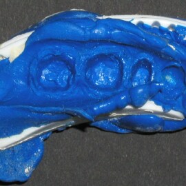 Dental impression distortions